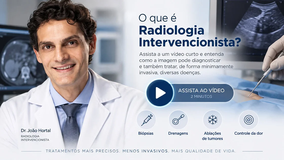 Vídeo do Dr. João Pedro Hortal explicando sobre radiologia intervencionista